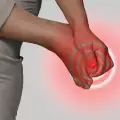 Šta da jedemo kod gihta?