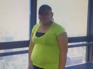 Pogledajte kompletnu promenu devojke koja je skinula 50 kilograma