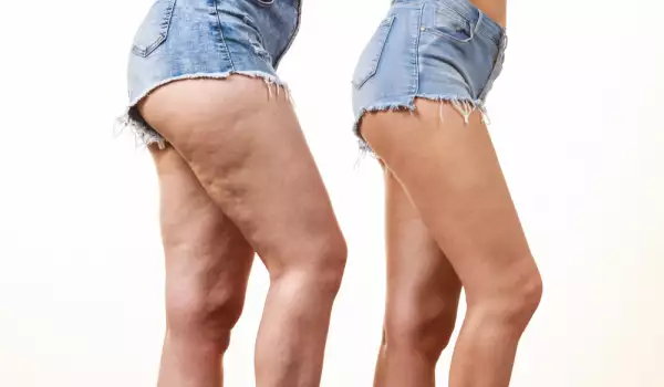 Moćni napitak za žene - za mršavljenje, blistavu kožu i lepu kosu!