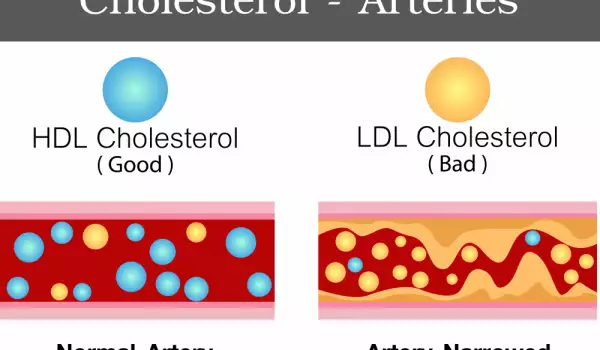 Šta je ukupni holesterol?